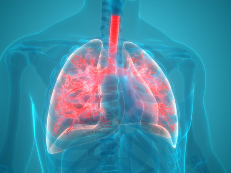 Hur Får Man Lunginflammation